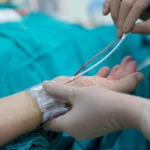 what you should know about coronary angiography 1