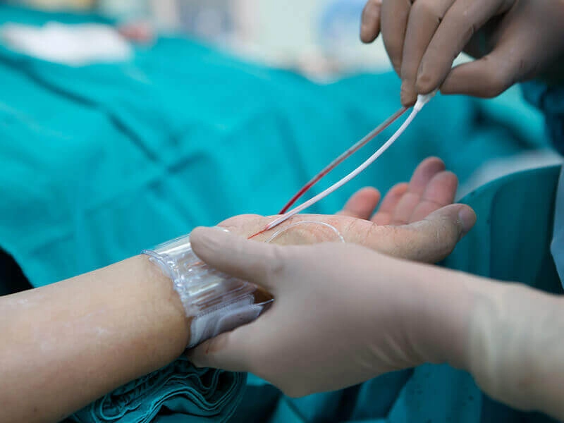 what you should know about coronary angiography 1
